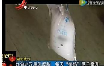 90后演员徐婷去世原因,演员徐婷淋巴癌症状