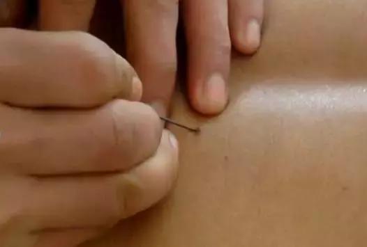 过了嘴瘾，上面舒服下面受折磨怎么破？