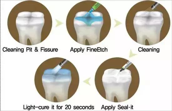 宝宝龋齿可能引发全身性疾病,妈妈必须知道的0~6岁牙齿护理