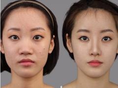 大鼻子不好看咋办,大鼻子好看还是小鼻子好看