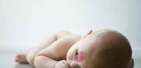 白色胎记的图片,胎记知多少基础篇