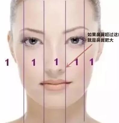 鼻子不好看能改善吗,大鼻子不好看怎么办