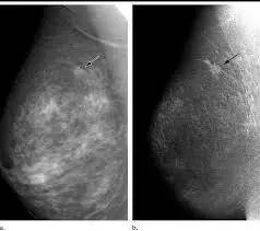 女人每年体检必须要做的项目,女性各年龄段必做的体检项目