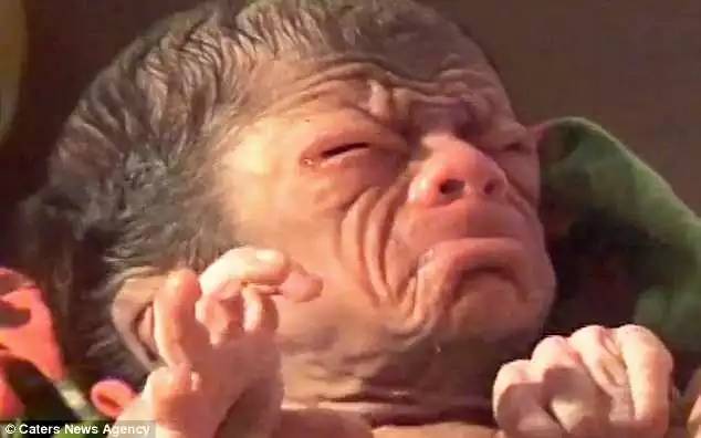 孟加拉刚出生孩子,孟加拉国婴儿现状