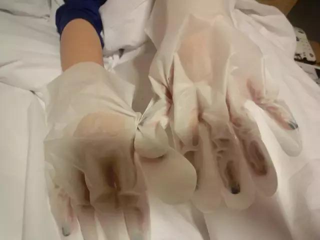 秋冬手部干燥粗糙肿么办?用对产品让你摆脱大妈手!