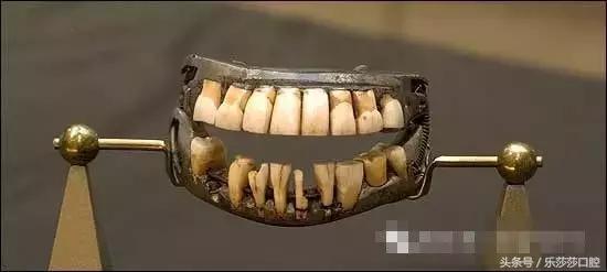 装一口假牙是怎样的一种体验？
