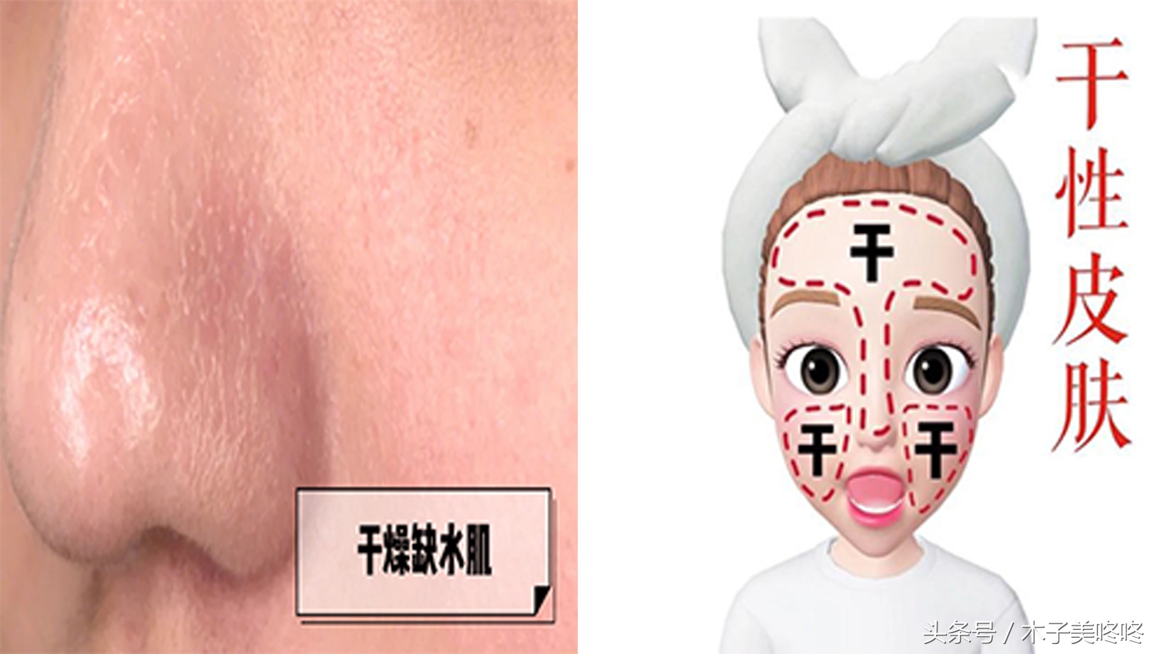 谣言粉碎机：控油产品可以减少皮肤出油？护肤知识大扫盲！