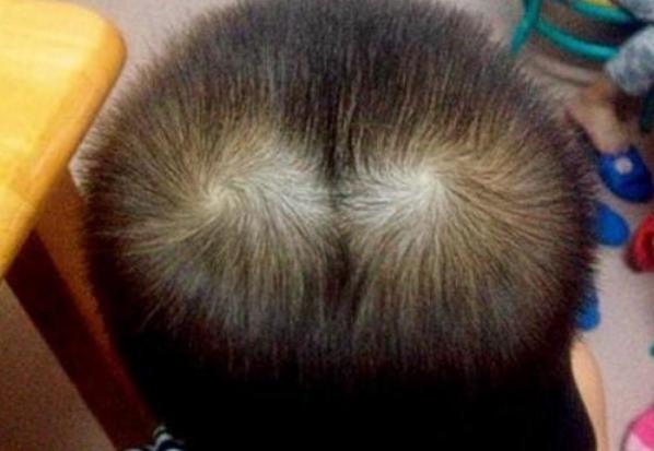 孩子头顶有两个旋性格,男孩头顶两个旋迷信说法