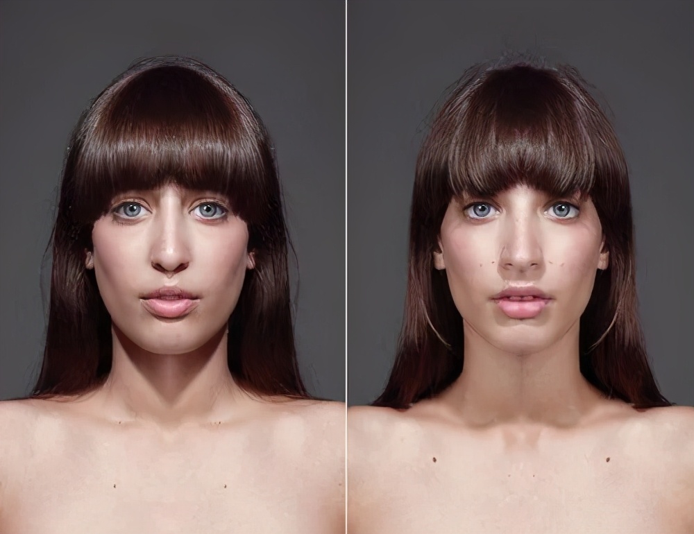 长期单边咀嚼后大小脸怎么恢复,单侧咀嚼大小脸可以恢复吗