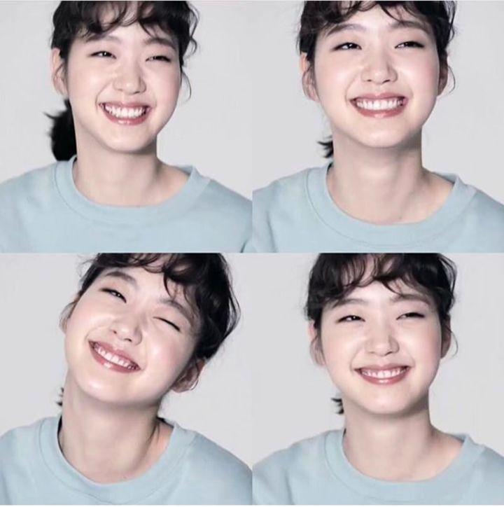 单眼皮怎么整容变双眼皮,嫌弃自己双眼皮小怎么办