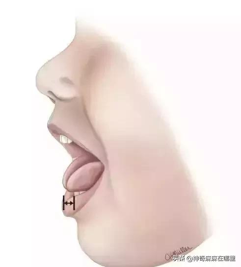 宝宝的舌头有点红怎么回事,宝宝的舌头有红点