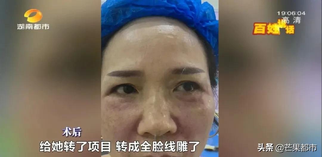 手术去除法令纹的效果到底怎么样,中医美容祛法令纹真的吗