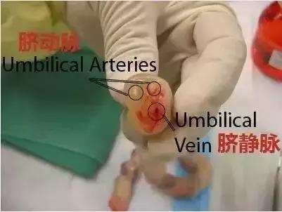 她破水后差点失去了宝宝,幸好没耽误1分钟!