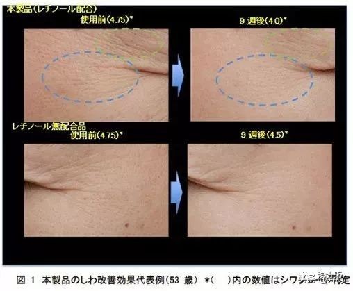 兰蔻眼霜和阿玛尼眼霜哪个去皱,眼霜哪个牌子抗皱祛皱效果最好