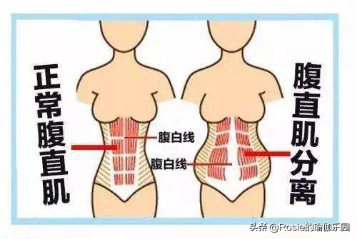 运动量过大腰疼怎么恢复,产后腰痛膝盖痛怎么锻炼