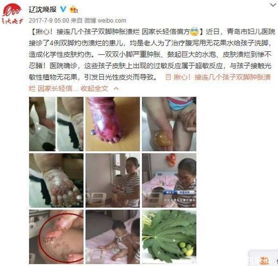 花椒面止血正确吗,花椒面止血吗