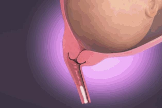 生宝宝到底有多疼看完这个就知道,生孩子到底有多疼让爸爸告诉你