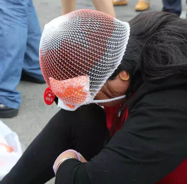 脑震荡问题大吗,脑震荡有什么后遗症