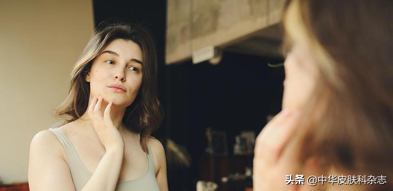 祛痘印痘疤最有用的药膏,激光祛痘印痘疤效果好吗