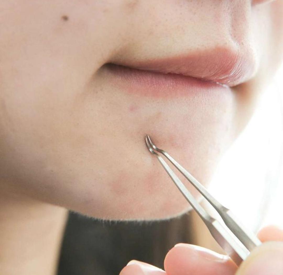 关于黑头的问题和解决方法,去黑头的误区许多人都中招了