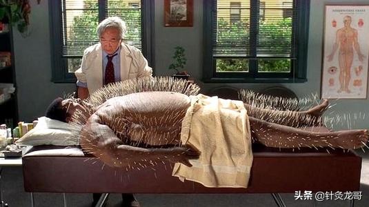 针灸时疼是筋不通吗,针灸感觉是酸胀好还是特别疼好