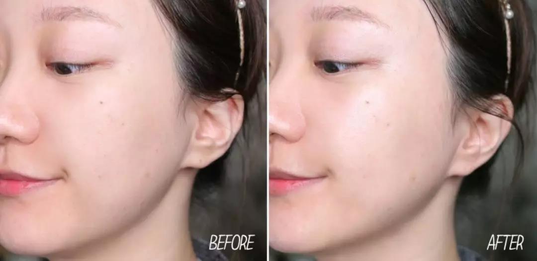 适合夏天油皮痘肌的水乳测评,fresh水乳适合敏感肌油皮