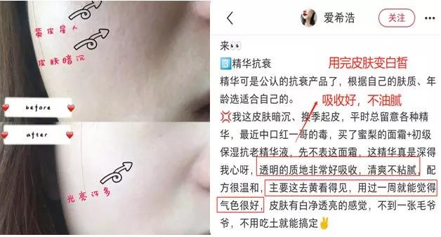 刘亦菲保养皮肤的方法,30岁皱纹多怎么修复