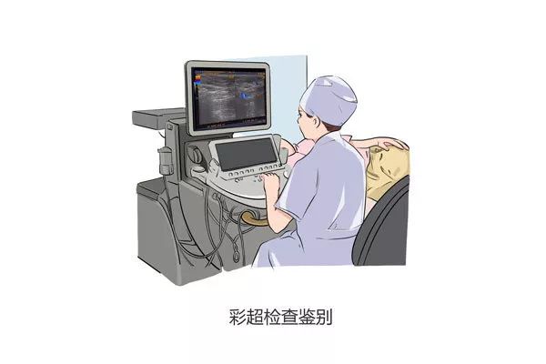 一图看懂乳腺癌免疫治疗,乳腺增生结节和乳腺癌的彩超区别