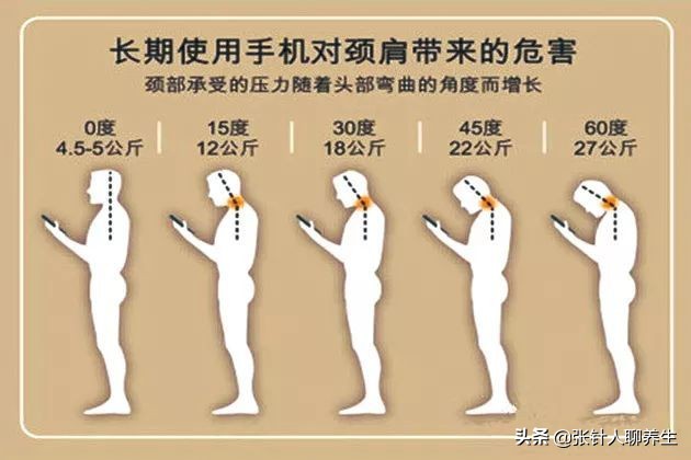 低头引起的颈椎疼痛和恶心,长期低头颈椎痛该如何治疗