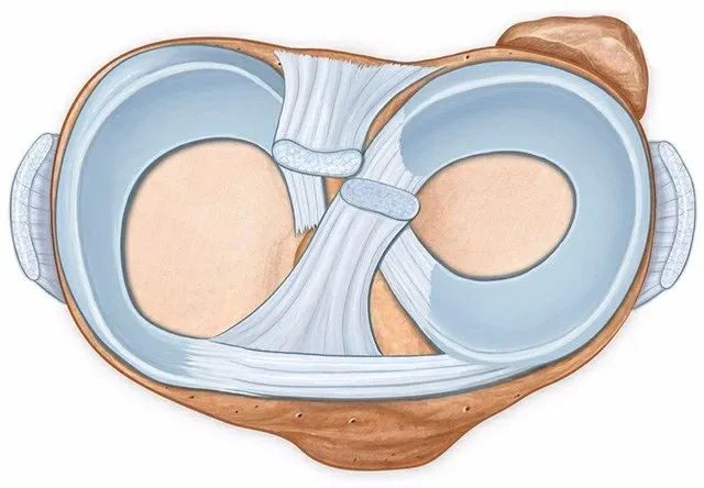 膝关节半月板损伤2-3度手术,半月板关节镜微创手术恢复状况