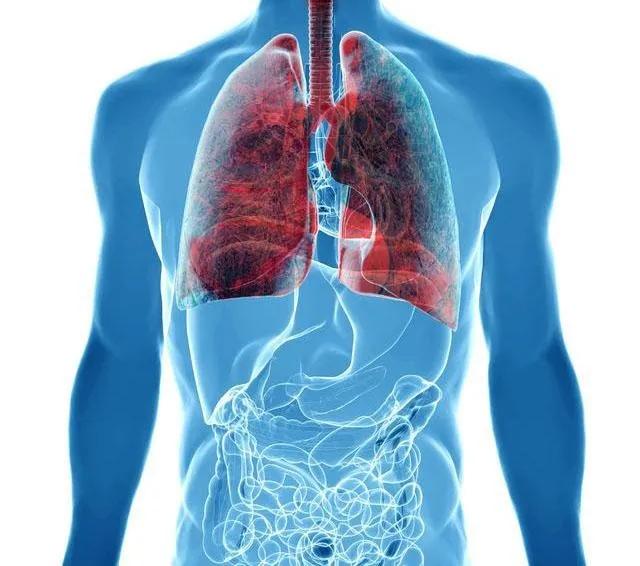 肺鳞癌对放疗化疗敏感吗,肺鳞癌对免疫治疗敏感靶向不敏感