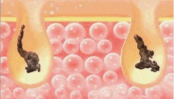 热卖搓澡巾,强力搓泥搓澡巾包邮