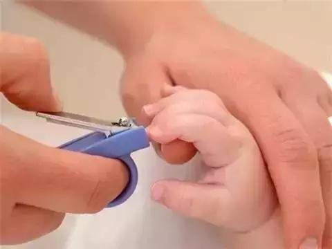 小朋友甲沟炎要拔掉整个指甲吗,小朋友甲沟炎怎么办