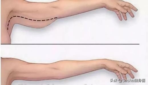 手臂的拜拜肉练什么动作最好,瑜伽减手臂拜拜肉最有效的动作