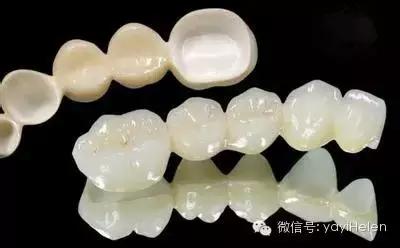德国3d无铍烤瓷牙能用多久,helen烤瓷牙