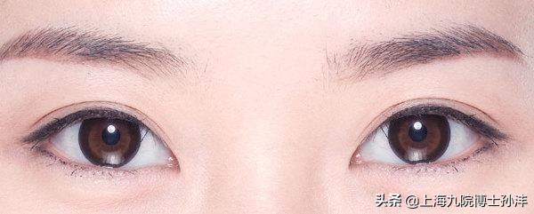 明明是双眼皮却老是不显为什么,为什么割了双眼皮反而不好看了