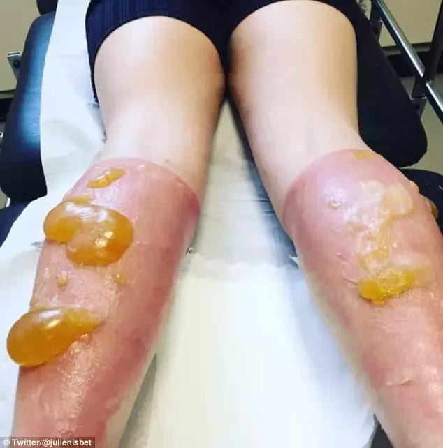 防晒丸是智商税吗,网红防晒喷雾有危害吗