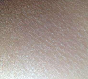 啥方法可以改善鸡皮皮肤,怎么有效去鸡皮肤的小妙招