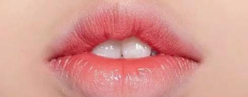 怎样改变凸嘴的小妙招,怎么改变凸嘴现象