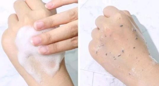 角质层的正确修复方法,怎么慢慢调理好自己的角质层