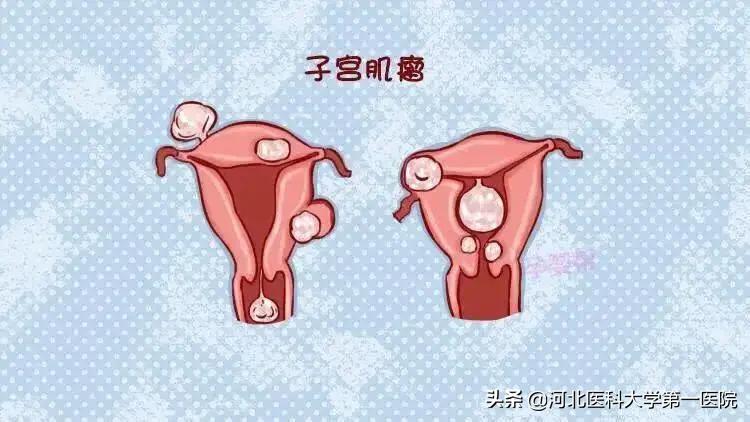 微创切除子宫宫腔镜好还是开刀好,探秘微创手术