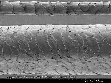 一夜白头是有心事吗,一夜白头是真实案例吗
