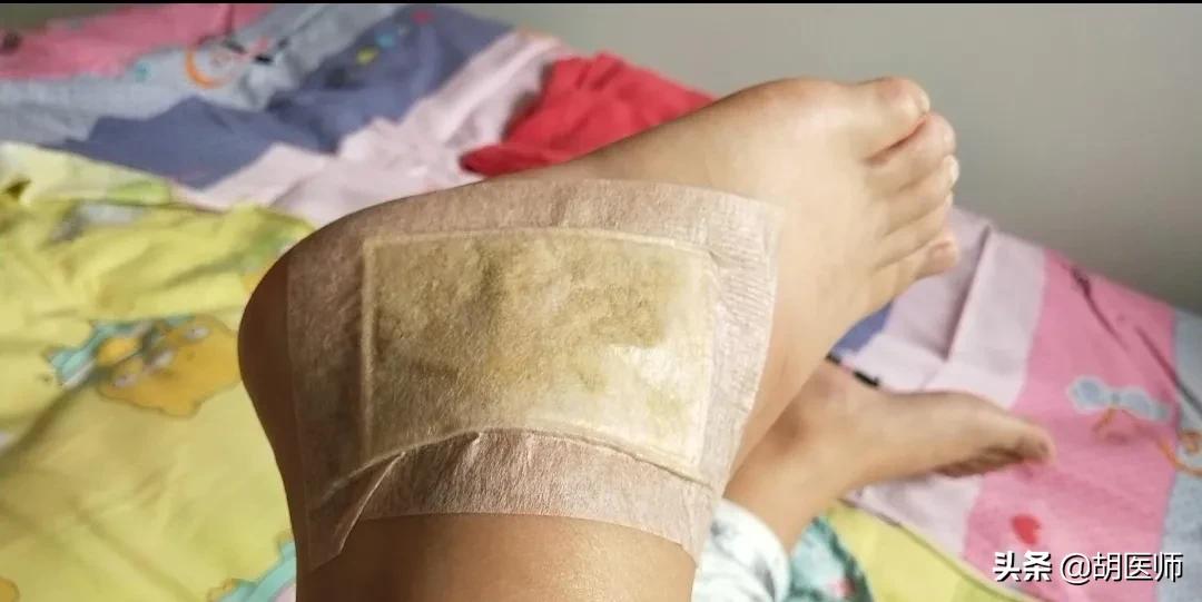 关于踝关节扭伤的正确处理方法,踝关节扭伤的早期处理原则是什么