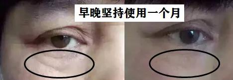 去眼纹去黑眼圈用什么方法,去眼袋眼纹公认最好用的土方法