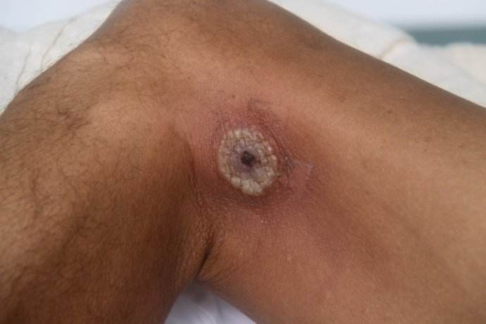 钓鱼用红虫会得病？胡说八道！真正的“害处”不在这