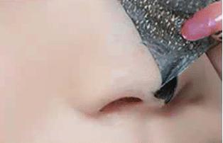 去白头的全部过程,去白头最好方法