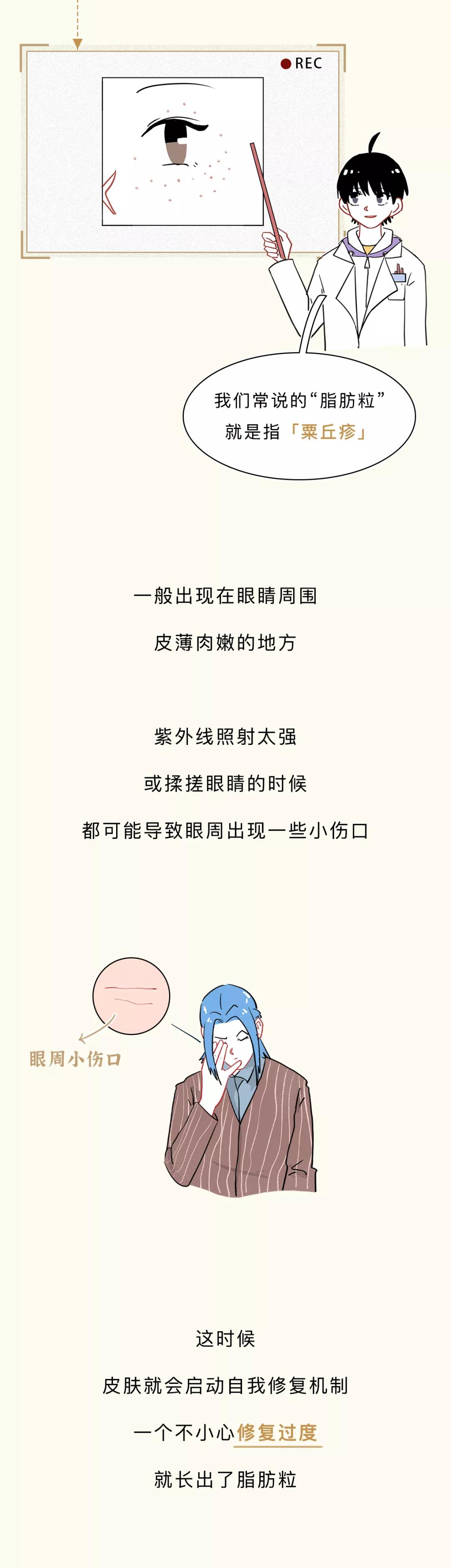 眼睛周围的脂肪粒到底是啥,眼睛周围长了脂肪粒怎么办