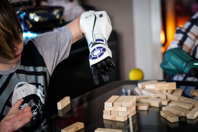 失去四肢的英国少年通过众筹，获《星球大战》仿生手臂得新生，