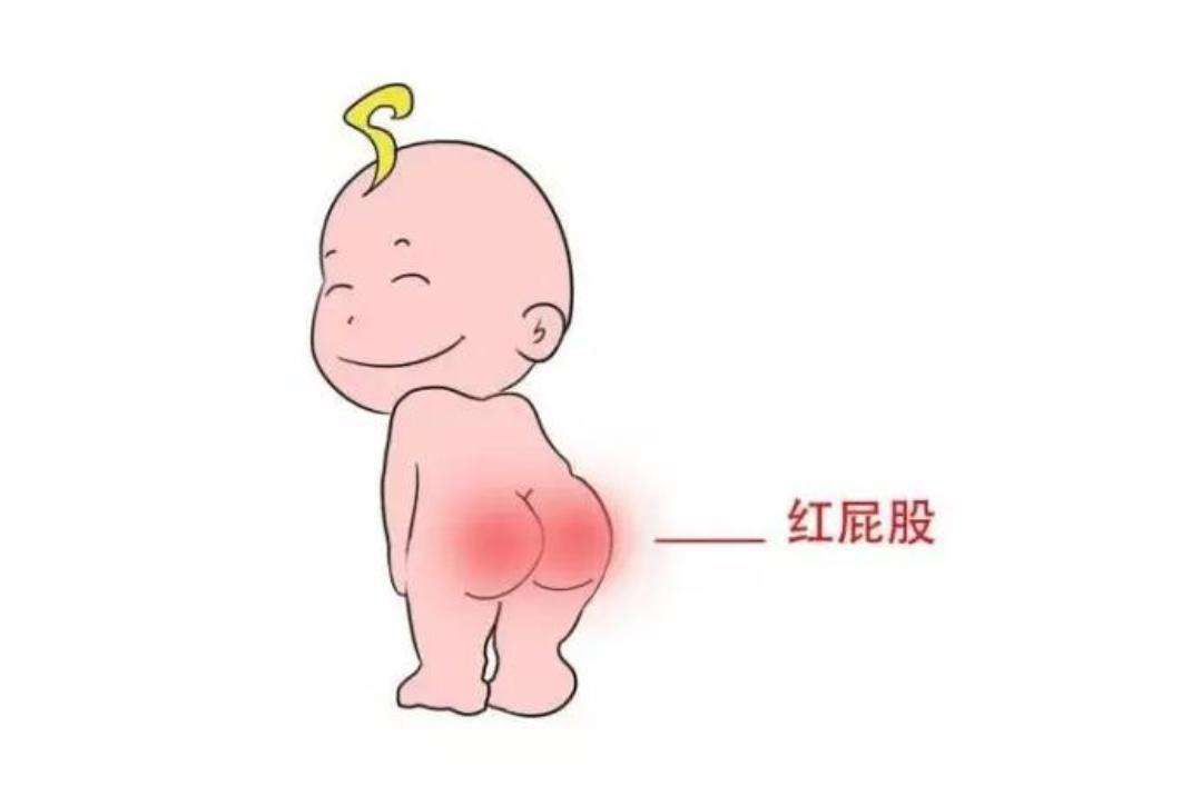 宝宝有了红屁屁，注意了以下几点，缓解很多了