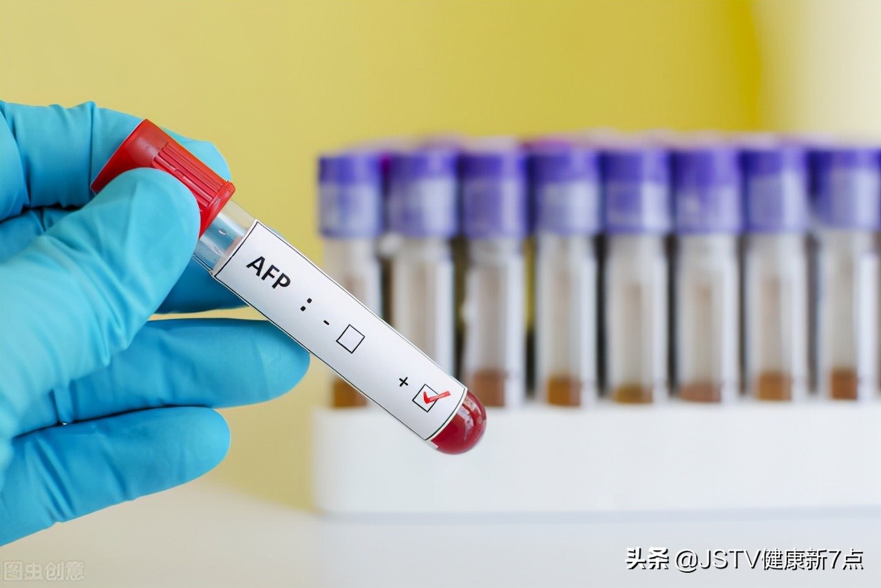 肿瘤标志物5项和全套标志物区别,广谱肿瘤标志物和单独肿瘤标志物
